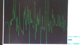 PSSM amp MIM Symptoms Tying Up [upl. by Cindelyn759]