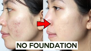 How to Cover Acne amp Blemishes WITHOUT Foundation • easy amp non cakey [upl. by Sergent]