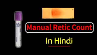 Reticulocyte count in hindi  Manual retic count  Principle  procedure amp interpretation [upl. by Orpha]