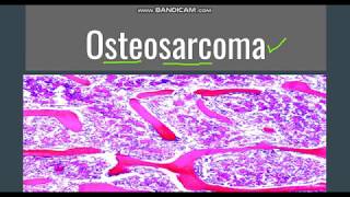 Osteosarcoma GeneralMorphology SubtypesClinical features [upl. by Griz]