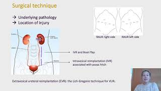 117 Robotic ureteral reimplantation for mid and distal ureter pathology in adults a case serie [upl. by Janey]