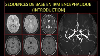 Séquences de base en IRM encéphalique Introduction [upl. by Orecic]