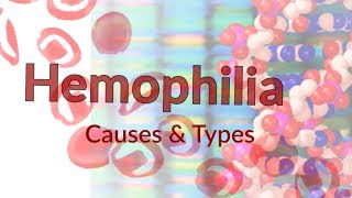 Hemophilia 101 for Emergency and Acute Care Physicians [upl. by Haduhey]