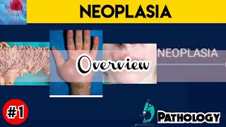 Neoplasia Pathology  introduction [upl. by Atikahs]