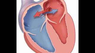 Fixed Split S2  Heart Sounds  MEDZCOOL [upl. by Anidem620]