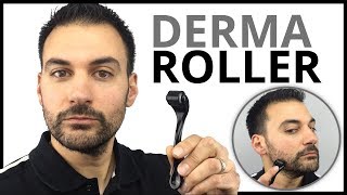 Derma Roller  Patchy Beard Growth Solution [upl. by Eirrej]