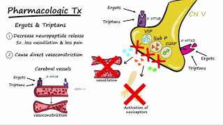 Migraines  Pathophysiology amp Treatment Described Concisely [upl. by Yelnek]