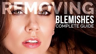 Complete Guide to Removing Blemishes in Photoshop [upl. by Risser]