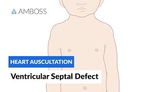 Atrial Septal Defect ASD Pathophysiology amp Clinical Features [upl. by Ynnam]