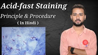 Acid fast staining procedure and principle in Hindi  Ziehl Neelsen Acid Fast staining procedure [upl. by Figueroa408]