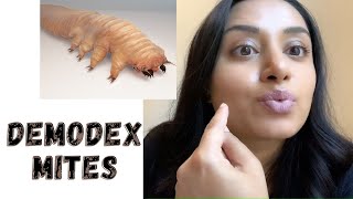 Demodex Mites on the FACE [upl. by Ahsenit]