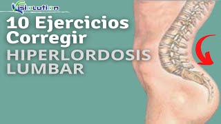 HIPERLORDOSIS LUMBAR 10 EJERCICIOS para CORREGIR y EVITAR el DOLOR LUMBAR  Fisiolution [upl. by Gae648]