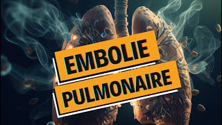 EMBOLIE PULMONAIRE et PHLEBITE  tout comprendre  WhyDoc 1 [upl. by Oirifrop]