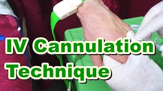 How to Insert IV Cannula  IV Cannulation Technique  Branula  Intravenous Catheter [upl. by Moskow673]