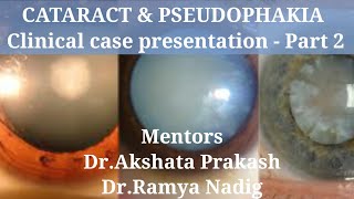 CATARACT amp PSEUDOPHAKIA Clinical case presentation  Part 2 [upl. by Ellekcim]