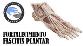 Fascitis plantar ejercicios de fortalecimiento [upl. by Kissel]