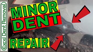 Minor Dent Repair  Paintless Dent Removal Truck Fender [upl. by Salas]