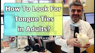 How To Look For Tongue Ties In Adults [upl. by Bough]