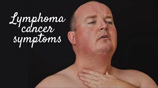 LYMPHOMA CANCER SYMPTOMS [upl. by Ayocat314]