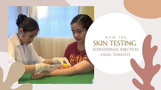 Intradermal InjectionSkin testing using Tomato [upl. by Ahsoj]