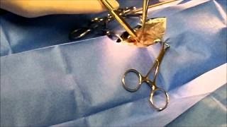 Baby Bird Surgery Prolapsed Cloaca Cloacopexy [upl. by Eselahc]