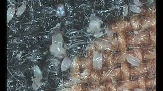 house dust mites [upl. by Forta]