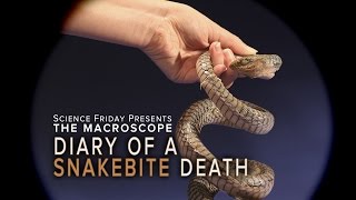 Diary of A Snakebite Death [upl. by Marko]