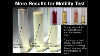 G I Motility  Gastrointestinal  Part 1 [upl. by Cattan46]