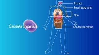 Sources of Candida Organisms [upl. by Rikki]