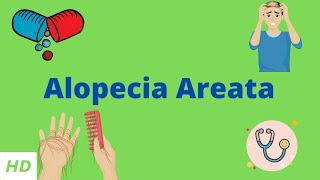 Alopecia Areata Causes SIgns and Symptoms Diagnosis and Treatment [upl. by Akeylah]