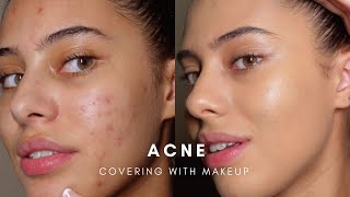 HOW TO COVER ACNE WITH MAKEUP BASE ROUTINE [upl. by Vargas]