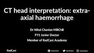 CT head interpretation extraaxial haemorrhage by Dr Nihal Chanian [upl. by Aleen]