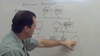 Autosomal Dominant Pedigree [upl. by Erminna132]