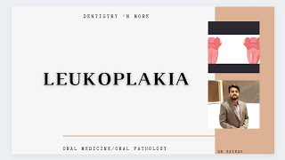 LEUKOPLAKIA [upl. by Nylyrehc]