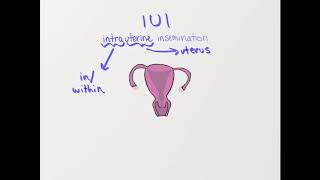 What is Intrauterine Insemination  Dr Ashwini GB [upl. by Ulund160]