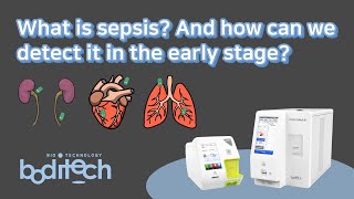 Sepsis and Septic Shock [upl. by Weathers]