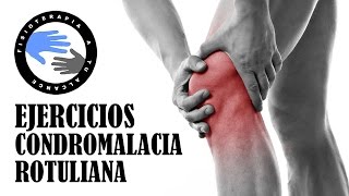 Ejercicios para condromalacia rotuliana o patelar [upl. by Adnicaj]