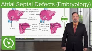 Atrial Septal Defect Primum Echocardiography [upl. by Barnet]