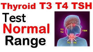 Thyroid Nodules  When to Worry Signs your nodule could be something more [upl. by Cavill323]