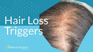 Common Hair Loss Triggers [upl. by Sitruk753]