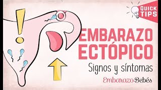 EMBARAZO ECTÓPICO 💔😭 Signos y síntomas [upl. by Ojimmas]