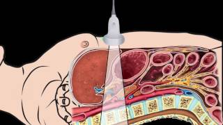 How to Perform and Interpret Peripheral Arterial Doppler Examinations [upl. by Gerard315]