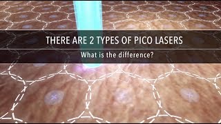 Why Are There Different Types of Pico Laser  Dr Kenneth Thean [upl. by Marnie450]