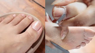 Relaxing DIY ASMR Pedicure Callus Feet  Water Sounds [upl. by Nahgiem]