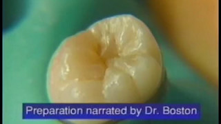 Fissurotomy®  How to Perform Minimally Invasive Fissure Exploration [upl. by Nadia]