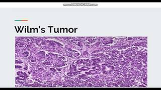 Wilms Tumor [upl. by Eniamor]