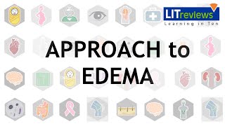 Approach To Edema [upl. by Beuthel]