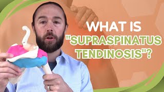 What is quotSupraspinatus Tendinosisquot shoulder pain [upl. by Vina]