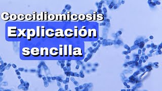 Coccidiomicosis fácil explicación [upl. by Florida364]