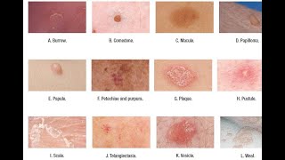 Skin Lesions with defination [upl. by Rafiq]